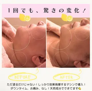 🎀BiBi韓国美容 コスパ強！美活サロンのエステ・リラクイメージ