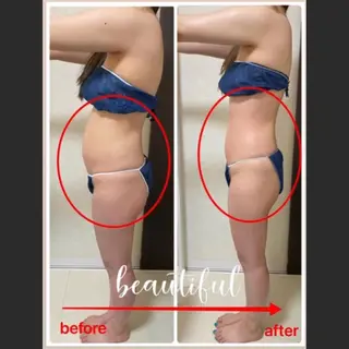 ダイエット／脱毛 美顔／フォト／ハーブのその他イメージ