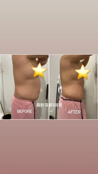 毛穴洗浄・痩身・脱毛 /アルカンジュのエステ・リラクイメージ