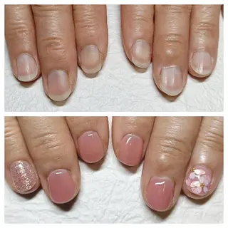 ネイル 深爪矯正/爪育成ケア manie nailのネイルデザイン