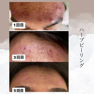 ピーリング専門店 Belluteのエステ・リラクイメージ