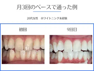 セルフホワイトニング エクシア岡崎店所属・ホワイトニング/脱毛 専門店エクシア岡崎店のその他イメージ