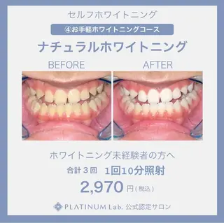 メンズ キッズ ネイル マツエク・マツパ アイブロウ プラチナムビューティー柏所属・【歯科提携】柏ホワイ トニングスタイルのその他イメージ