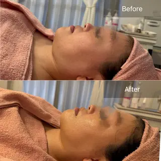Salon de lala所属・女性限定Salon de lalaのエステ・リラクイメージ