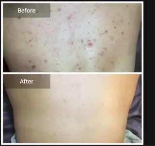 ハーブピーリング 専門店MOKA所属・ハーブピーリング専門 MOKAのエステ・リラクイメージ