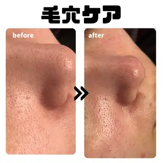 ローザエメ Reiaのエステ・リラクイメージ