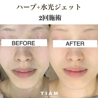 美肌サロンTIAM by tetoteのエステ・リラクイメージ