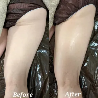 整体エステ　NEW ME所属・深層リンパオイル/小 顔とドライヘッドスパのエステ・リラクイメージ