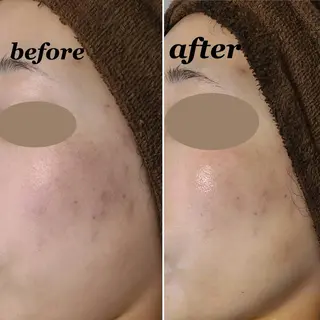 total beauty DIAのネイルデザイン