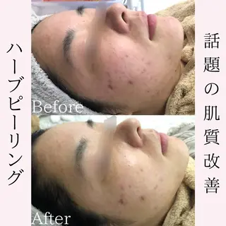 BestBelleꕤ 大阪福島/肌質改善のエステ・リラクイメージ