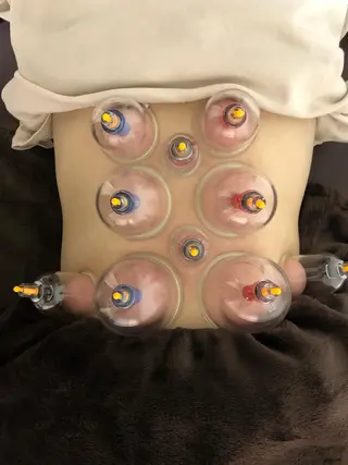 やはた鍼灸整骨院所属・やはた 鍼灸整骨院のエステ・リラクイメージ