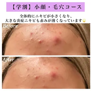 Bellesthe (ベルエステ)のエステ・リラクイメージ