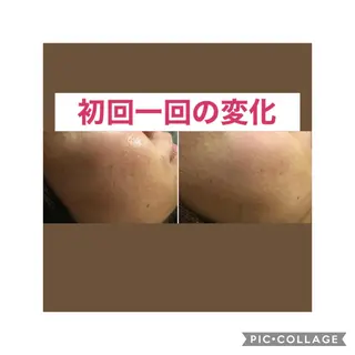 セミロング カラー パーマ ヘアアレンジ メンズ キッズ ネイル マツエク・マツパ アニメ,Vオタク× 即効痩せエステサロンのエステ・リラクイメージ