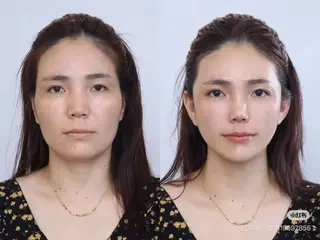 ショート aliaハイフ&水光ジェットサロン所属・aliaハーブ水光店 エステティシャン募集のエステ・リラクイメージ