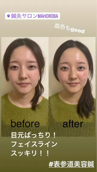 美容鍼灸サロン mahoroba院長のエステ・リラクイメージ