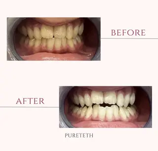 メンズ ホワイトニングサロンPURETETH所属・ホワイトニングサロン PURETETHのエステ・リラクイメージ