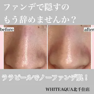 WHITE AQUA 北千住店のエステ・リラクイメージ