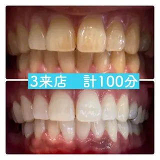 PLATINUM Beauty 横浜店所属・ホワイトニングルーム 横浜店のその他イメージ