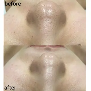 Dahlia Beautyのネイルデザイン