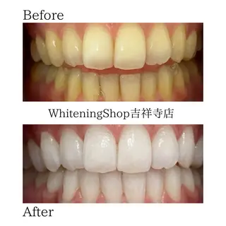 ホワイトニング ショップ吉祥寺店のエステ・リラクイメージ