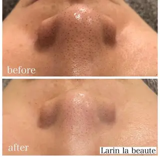 美肌脱毛・ハーブピーリング専門店Larin la beaute所属・Larin la beauteのエステ・リラクイメージ