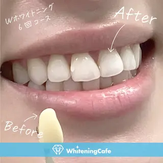 ホワイトニングカフェ神戸元町店所属・ホワイトニングカフェ 神戸元町店のエステ・リラクイメージ