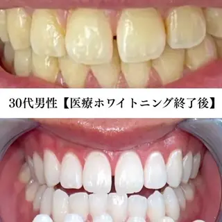 キッズ メンズ ホワイトニングサロン WHITE福岡博多店のエステ・リラクイメージ