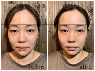 💎後悔させない小顔 矯正💎イトヤマ🌱のエステ・リラクイメージ