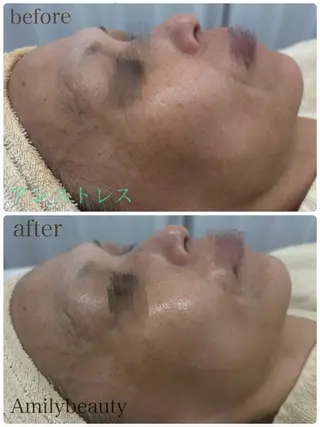 Amilybeauty所属・Amily beauty 毛利のその他イメージ