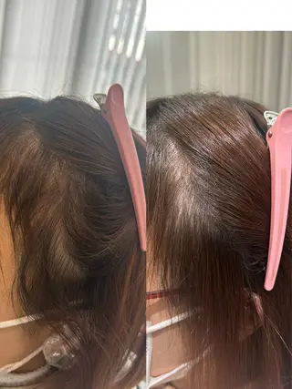 ロング 縮毛矯正・癒し ヘッドスパ🧸ここなのヘアスタイル
