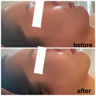 FLEUR大阪・整体 ・ハイフ・痩身・小顔のエステ・リラクイメージ