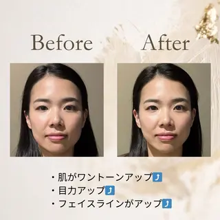 あさば整体院　三ノ輪店所属・美容鍼✨あさば整体院 三ノ輪店のエステ・リラクイメージ