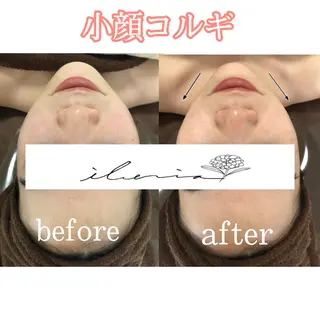 心斎橋痩身ダイエット 韓国.美容鍼.小顔のエステ・リラクイメージ