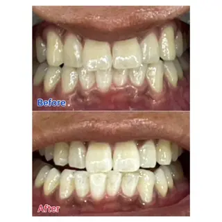 MBEAUTYSALON 千葉店・京成大久保所属・Melty 輝のその他イメージ