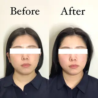 Hari Lounge恵比寿所属・chika🦋 ハリラウンジ恵比寿のエステ・リラクイメージ