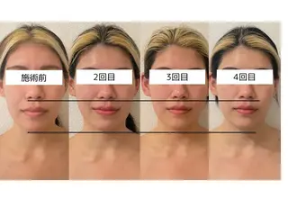 小顔/たるみ/黒ずみ除去専門サロン/SONA 大和西大寺店所属・【小顔専門看護師 サロンSONA】のエステ・リラクイメージ