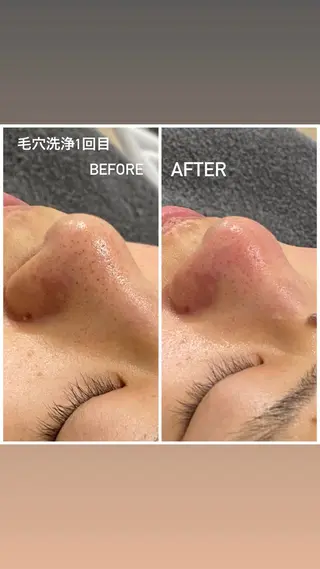 毛穴洗浄・痩身・脱毛 /アルカンジュのエステ・リラクイメージ