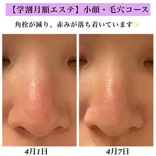 Bellesthe （ベルエステ）のエステ・リラクイメージ