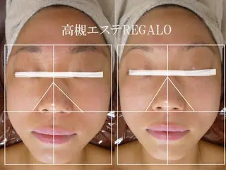 REGALO所属・矢野 さやかのエステ・リラクイメージ