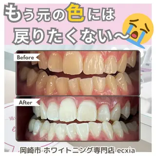 セルフホワイトニング エクシア岡崎店所属・ホワイトニング/脱毛 専門店エクシア岡崎店のその他イメージ