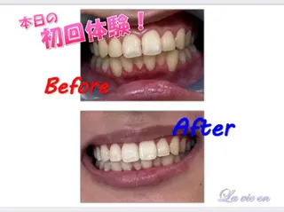 セルフホワイトニングサロン　ラヴィアン所属・ホワイトニングサロン La vie enのその他イメージ