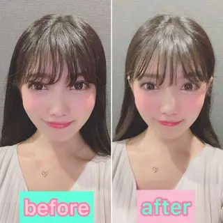 美容鍼灸サロン LOMIHARIのエステ・リラクイメージ