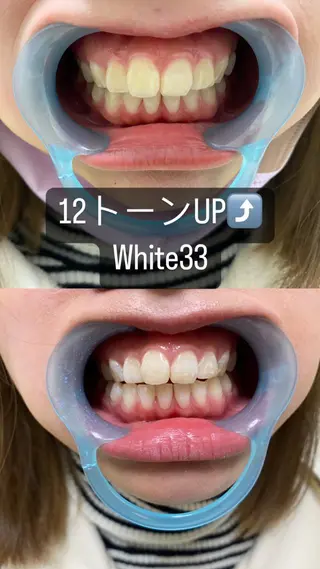 メンズ セルフホワイトニング White33大名のその他イメージ