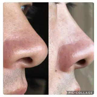 SHINY エステサロンのその他イメージ