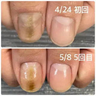 ネイル 奥園 良恵のネイルデザイン