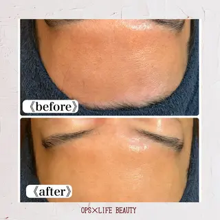 メンズ OPS×LIFE BEAUTY所属・OPS×LIFE BEAUTY/maiのエステ・リラクイメージ