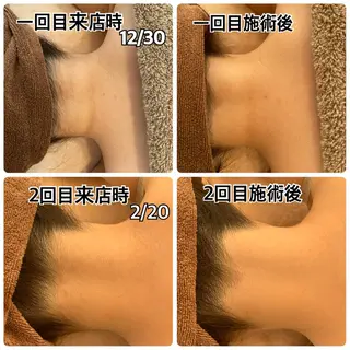 美肌コラーゲン脱毛SINCERITE【サンセリテ】所属・瀬野 のぞみのエステ・リラクイメージ
