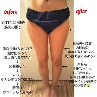 【ニキビ/肌管理】 salon varyのエステ・リラクイメージ