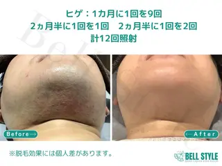 メンズ メンズ&レディース　Bell style所属・【脱毛・美肌専門】 bellstyleのエステ・リラクイメージ