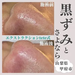 salon MUSUBUのエステ・リラクイメージ